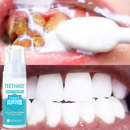 Teethaid™ Pure Herbal Super izbjeljivanje i pjena za obnavljanje zubi i usta i jednostavno uklanjanje zubnog kamenca